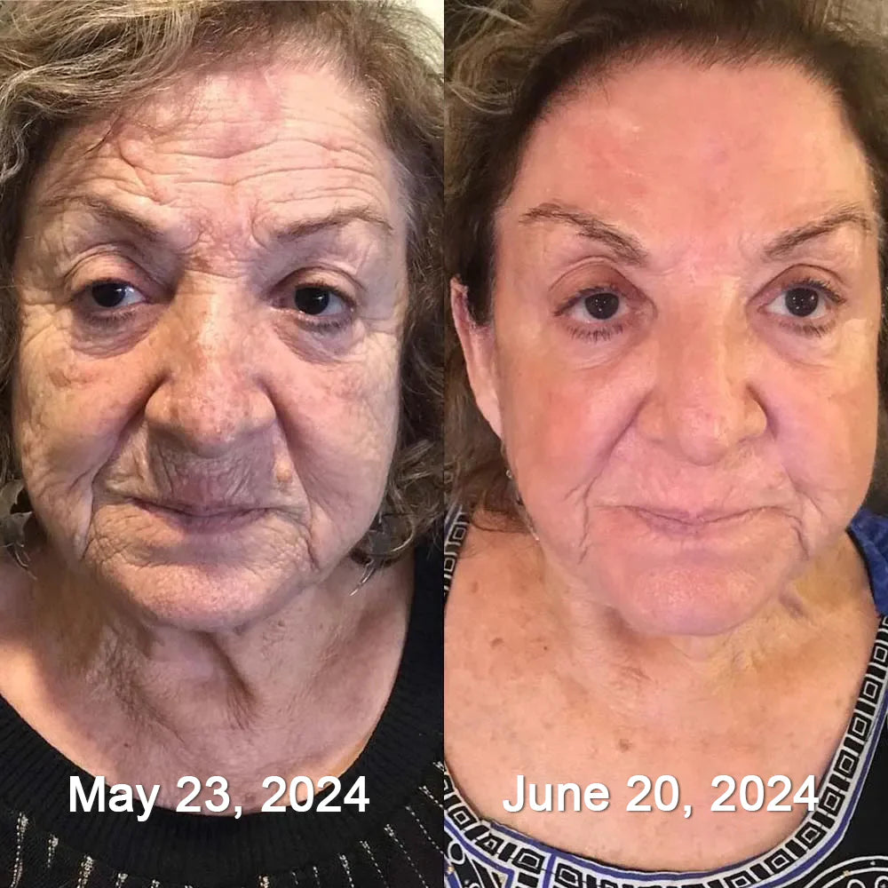 Bee Venom Wrinkle Remover Cream